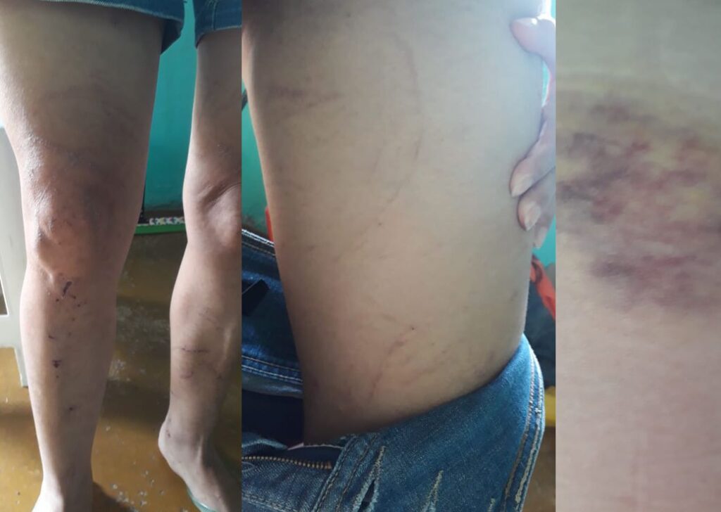 Ireni-Almeida-Chaves-A3-1024x728 Relato e sofrimento de vítima que sofreu tentativa de feminicídio choca moradores de Araguacema