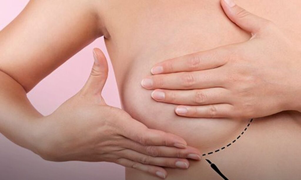 Cancer-de-mama-ok-1024x613 Medicamento para tratar câncer de mama é incorporado ao SUS
