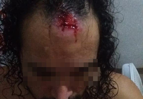 Lagoa Lagoa da Confusão: Mãe de autista se revolta com material usado para tratamento de lesão do filho