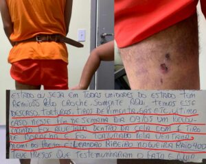 Familiares de preso denunciam suposta torturas no presídio de Cariri